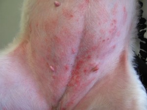 Atopic Dermatitis